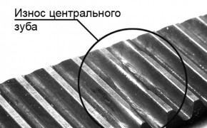 Износ зуба